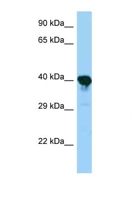 Polyclonal Rabbit anti-Mouse PRPSAP1 Antibody (aa22-71, WB)