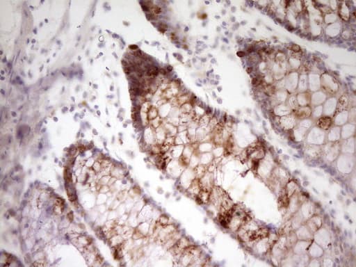 VEGFD Antibody (aa89-205, clone OTI1C7)