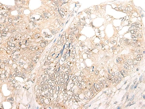 DCP2 Antibody