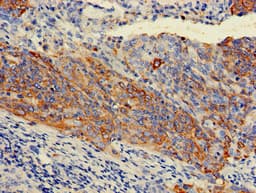KRT7 / CK7 / Cytokeratin 7 Antibody