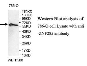 Polyclonal Rabbit anti-Human ZNF285 / ZNF285A Antibody (aa149-418, WB)