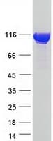 Human AMPD3 Protein (Recombinant Myc-DDK (Flag))