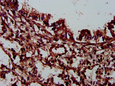 PLEC / Plectin Antibody