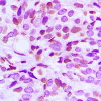 HMG20B / BRAF35 Antibody (N-Terminus)