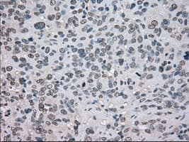 TSC501 / NAT8 Antibody (clone OTI6H3)