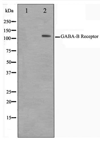 GABBR1 / GABA B Receptor 1 Antibody