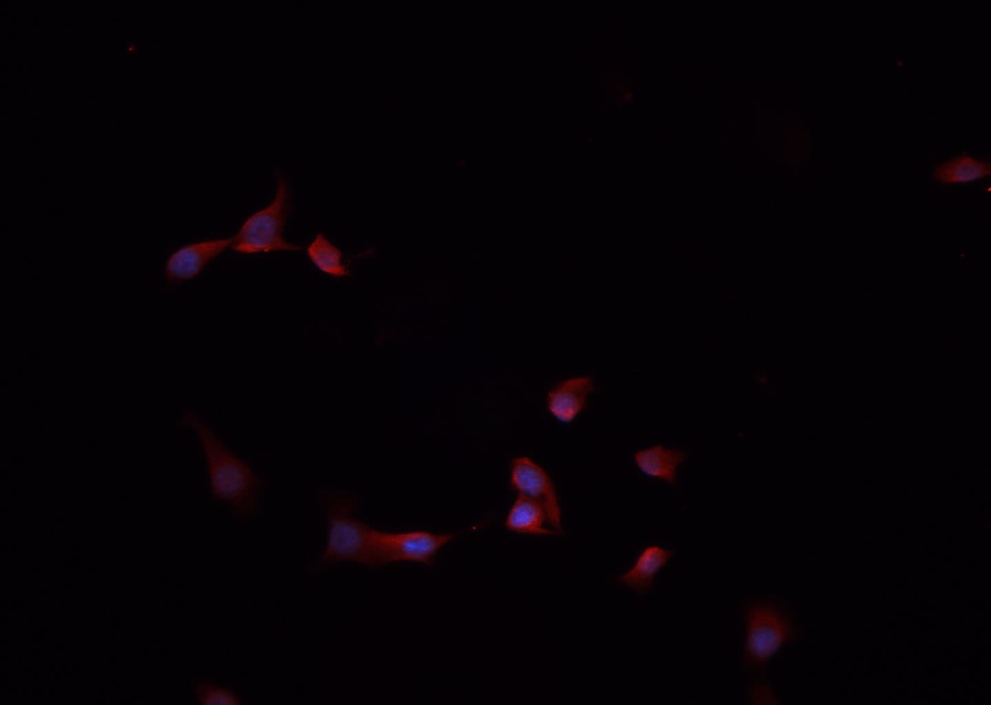 Polyclonal Rabbit anti-Human LGALS3 / Galectin 3 Antibody (IHC, IF, WB)