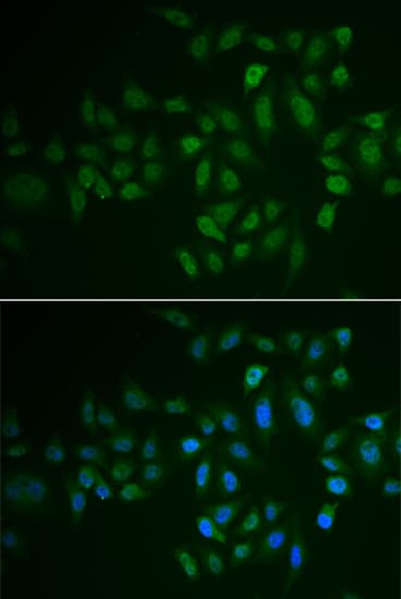Polyclonal Rabbit anti-Human MYLK3 Antibody (IHC, IF, WB)