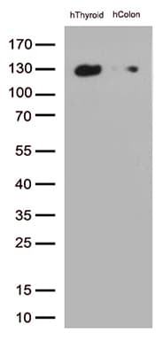 CDH1 / E Cadherin Antibody (clone UMAB184)