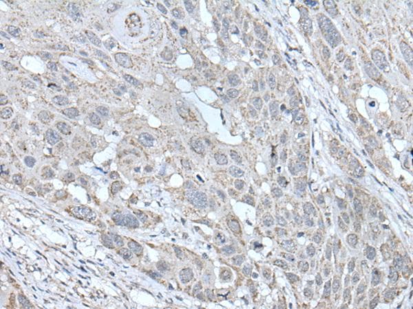 SCNN1G / ENaC Gamma Antibody