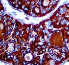 Monoclonal Mouse anti-Human TG / Thyroglobulin Antibody (clone 2H11/6E1, IHC)