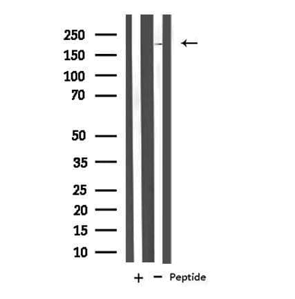 NCAN / Neurocan Antibody