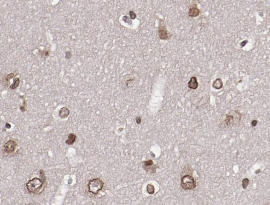 AKT1 Antibody (phospho-Ser473)