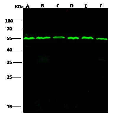 TUBB / Beta Tubulin Antibody (clone 05, Preservative Free)