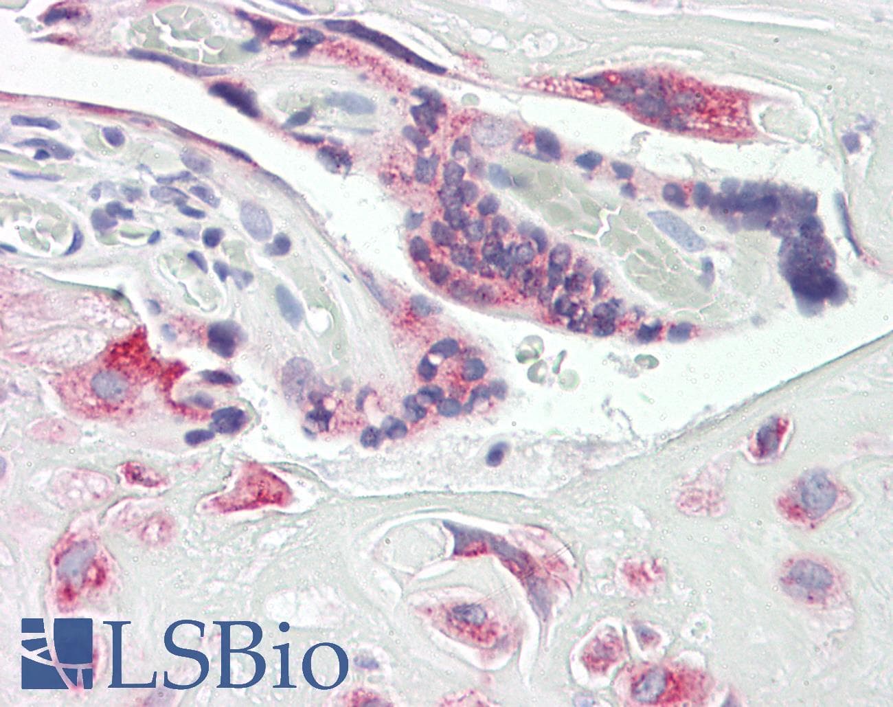 IHC-plus™ Polyclonal Rabbit anti-Human DUSP9 Antibody (aa151-200, IHC, IF, WB)