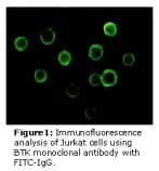 Monoclonal Mouse anti-Human BTK Antibody (clone 7F12H4, IHC, IF, WB)