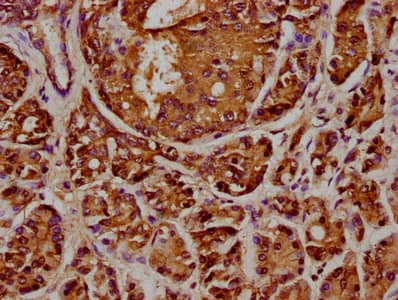 Polyclonal Rabbit anti-Human ANAPC2 / APC2 Antibody (IHC)