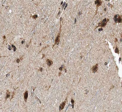 FHIT Antibody