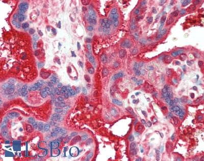 IHC-plus™ CAST / Calpastatin Antibody