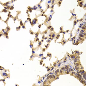 Polyclonal Rabbit anti-Human PPP2R1B Antibody (IHC, WB)