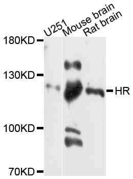 Polyclonal Rabbit anti-Human Hairless / HR Antibody (WB)