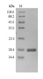 Serratia marcescens hns Protein (Recombinant 6His, N-terminus)