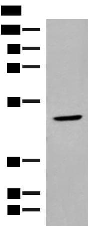 zinc finger and BTB domain containing 8 Antibody
