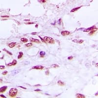 Polyclonal Rabbit anti-Human LIG4 / DNA Ligase IV Antibody (Internal, IHC, WB)