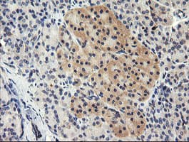 TAPBPL / TAPBPR Antibody (clone OTI2A4)