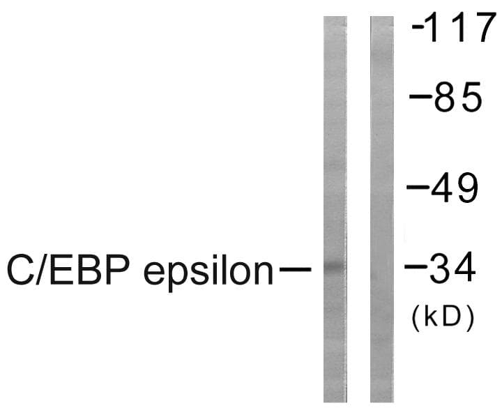 Polyclonal Rabbit anti-Human C/EBP Epsilon / CEBPE Antibody (p74, IHC, IF, WB)