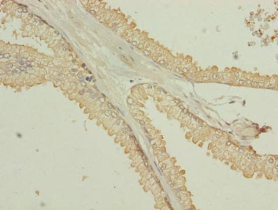 Polyclonal Rabbit anti-Human TMEM140 Antibody (IHC)