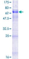 Human SLC29A1 / ENT1 Protein (Recombinant GST)