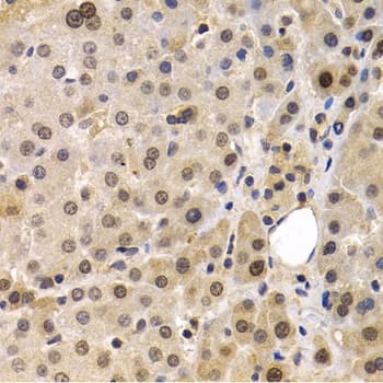 MAGEA1 / MAGE 1 Antibody