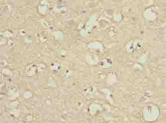 ENPP6 Antibody