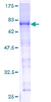Human F10 / Factor X Protein (Recombinant GST)