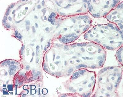 IHC-plus™ EGFR Antibody (aa1041-1090)