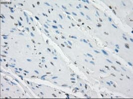 AURKC / Aurora C Antibody (clone OTI2B7)