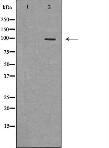 Polyclonal Rabbit anti-Human TLR5 Antibody (IHC, WB)