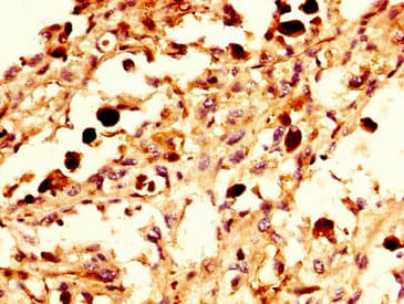 Polyclonal Rabbit anti-Human NXF / NPAS4 Antibody (IHC, WB)