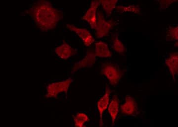 DVL2 / Dishevelled 2 Antibody