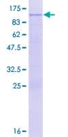 Human DDX41 / ABS Protein (Recombinant GST)