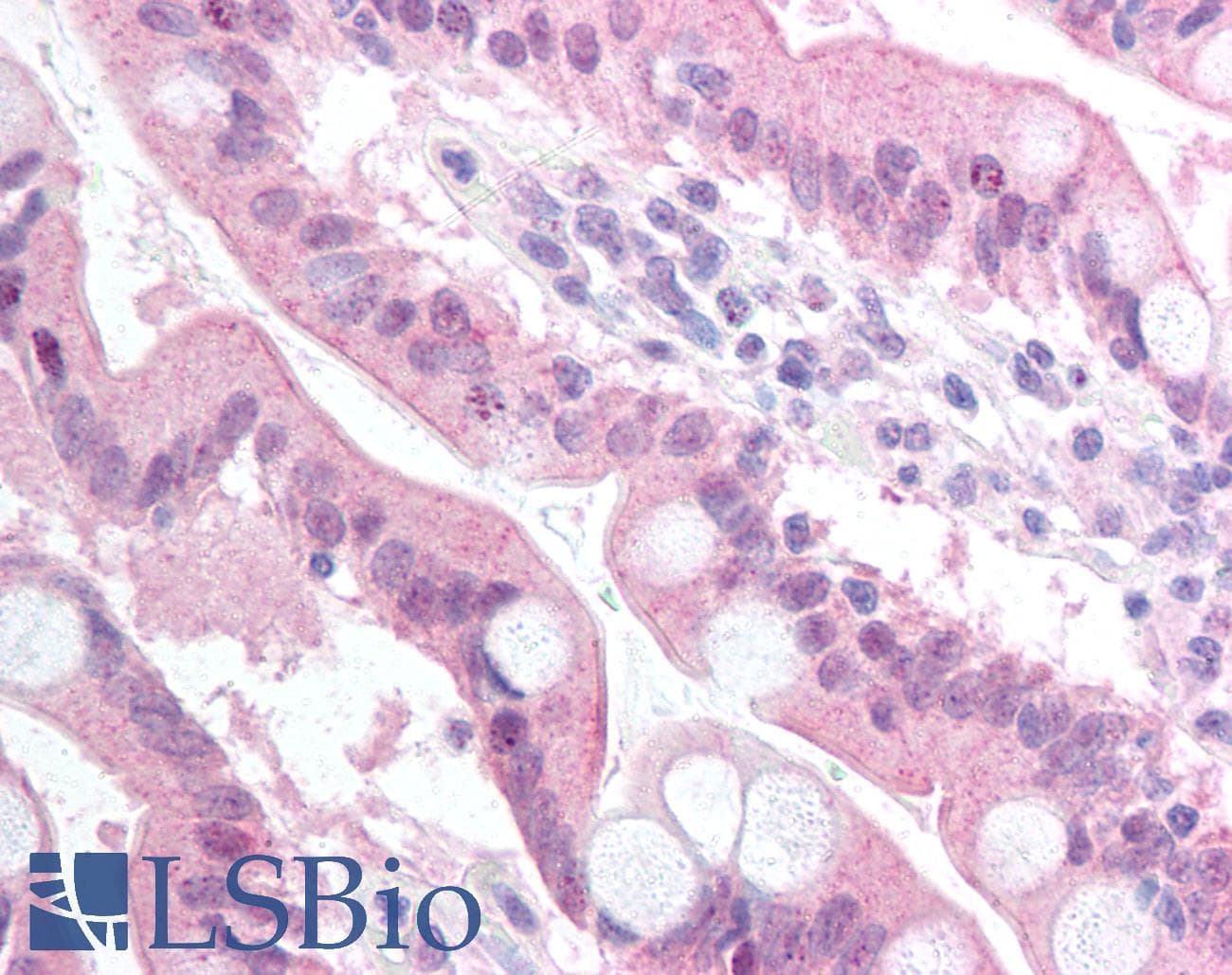 BCL2A1 Antibody