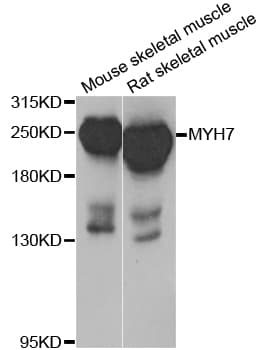 IHC-plus™ Polyclonal Rabbit anti-Human MYH7 Antibody (IHC, WB)
