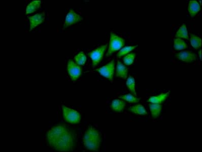 SOS1 Antibody