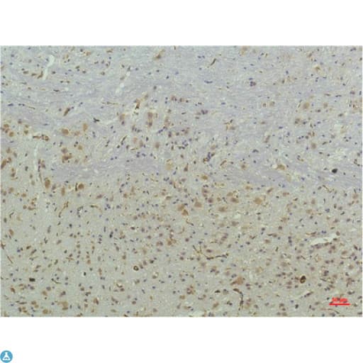 PPARD / PPAR Delta Antibody