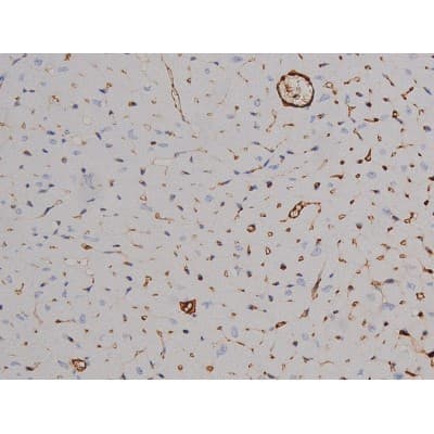 STAT6 Antibody (phospho-Thr645)