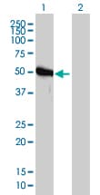 IHC-plus™ Monoclonal Mouse anti-Human GART / GARS Antibody (clone 4D6-1D5, IHC, IF, WB)