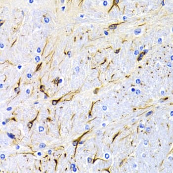 DRD1 / Dopamine Receptor D1 Antibody (aa338-446)