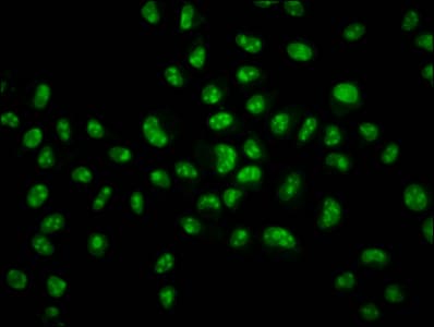 HIST1H2BN Antibody