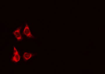 Polyclonal Rabbit anti-Human TNFRSF6B / DCR3 Antibody (IHC, IF, WB)